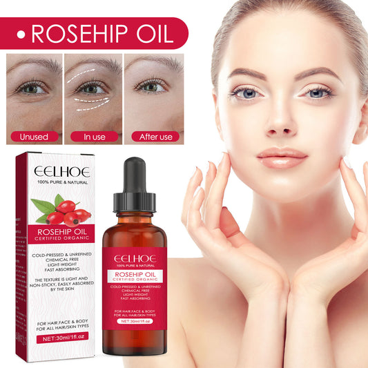 Rosehip Facial Oil For Facial And Body Hydration, Nourishing Skin Care, Smooth Hair Care, And Massage Oil